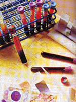 virus1.GIF (27416 bytes)